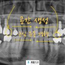 세움치과기공소 네이버블로그