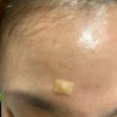 크리스탈피부과의원 이미지