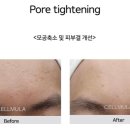 홈케어끝판왕 이미지