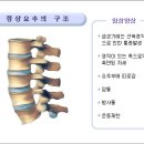 요추염좌란?| 이미지