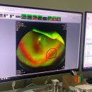 양재성모안과의원 이미지