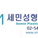세민성형외과의원 네이버블로그