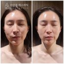이정옥코스매턱화장품 | 대연동 맞춤 피부관리 추천 5가지 기준 - 실패 없는 선택법
