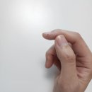 [후기] 사마귀 냉동치료 후기 / 고통, 후관리, 비용