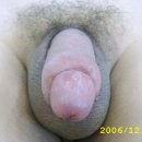 웰빙비뇨기과 Daum카페
