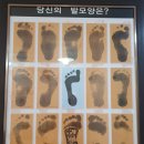 알즈너영화