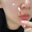 진정 | 여드름크림 엔카 유황크림 얼굴 트러블 진정 스팟 케어후기