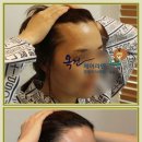 연 헤어라인