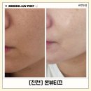 리베온 | 무너진 장벽 살리는 리베룩 최초 입점 진천 피부관리 온뷰티끄