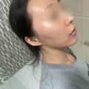 오라클 피부관리 | 강남역 다이소 뷰티 꿀템 닥터오라클 큐어소나 더마 쿨러 후기(쿨링마사지, 아이스롤러, 쿨링스틱)