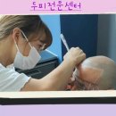 모락스칼프 이미지