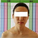 경락마사지 이미지