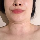 마레메디칼 | 부산피부관리 가봄더라인 전포점 울트라갸름젯 후기