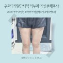 구로디지털단지역 | 지방분해주사로 군살 끝판왕! 구로디지털단지역 피부과 제로팻 후기