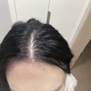 엠포로스 | 산후 두피관리 두피에센스 엠포로스 셀리젠 헤어 볼륨 마이징 토닉