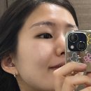 마포/홍대 │ 깔끔하게 지워버린 눈썹문신(잔흔제거) @모제이 @MO.J