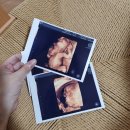 (주)전우정밀 | 쌍둥이 임신기록, - 30주​