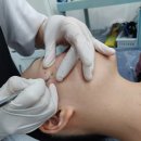 부천피부관리 여드름 압출 받고 관리받은 내돈내산 후기! 예쁘미스킨앤두피