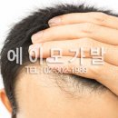 에이모가발 이미지