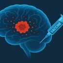 알츠하이머 백신 개발… 치료∙예방 가능 “상용화 기대" 이미지