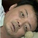 안녕약국 | 코골이방지기구 약국 운동으로 극복한 후기