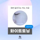 압구정 이유클리닉 피부과 화이트토닝 색소치료 리얼후기