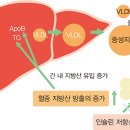 고지혈증이란 무엇이고 당뇨병 환자에서 왜 생기나 이미지