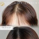 하이스칼프 이미지