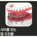 아치치과기공소 이미지