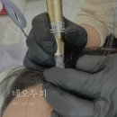 권동하 | 구로탈모관리 두피MTS로 관리하세요! 네오두피 smp전문점