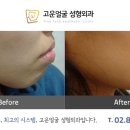 고운얼굴 이미지
