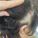 부안노인여성회관 | 부안보청기, 💛 시그니아 7AX 보청기 착용후기심하지 않은 난청 · 70대 여성 고객님 후기