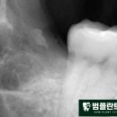 범플란트치과의원