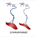 능동국시 | [물리치료사 국시공부] 척수손상(SCI)과 질환의 검사 및 종류