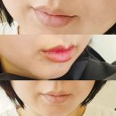 세븐일레븐 동탄파크점 | 동탄 입술문신, 회색 입술 고민 끝! 통증 없는 립타투 찐후기