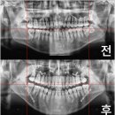 김영재치과의원 네이버블로그