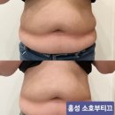 GR(홍성군)-[내포로]-하-25 | 내포바디관리 홍성 소호부티끄에서 융복합에너지테라피로 건강해지쟈!!