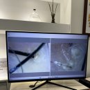 (주)화성그린 | 화성동탄탈모케어 : 모앤뷰티탈모 후기