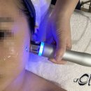 피부천재연구소 | 대구피부관리 맑아진 피부 느낀 피부천재연구소 후기