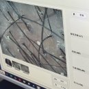 금샘빌딩 | 부산대 두피관리 웰킨두피탈모센터, 지루성 두피 진정케어 후기
