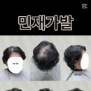 민재가발 이미지
