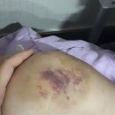 주식회사 이센 | 무릎 통증 헬스케어 제품 후기 [이센케어] 에버닌