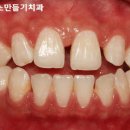 오승훈치과의원 네이버블로그