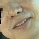 부천아이디의원 | 부천시청역 아이디의원 기미주근깨 실종 후기