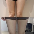 선정릉역 피부과 강남구청역 바디 리니어지 후기 일주일차! 여름맞이 허벅지 다이어트 내돈내산