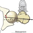 고관절(hip joint) 관절가동, 수기저항운동, 자가운동, 기능적 운동법 - 정리중 이미지