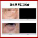 유투성형외과의원 이미지