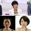 루이스치과 네이버블로그