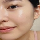 프라임 | 울쎄라 프라임 통증 효과 후기 울쎄라 차이 가격 확실히 좋아졌네요