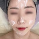 보누스킨